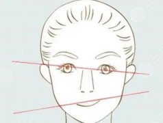 磨骨改臉型有后遺癥嗎？出現(xiàn)后遺癥該如何應(yīng)對(duì)？費(fèi)用參考