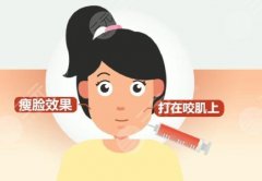 射頻溶脂瘦臉會(huì)反彈嗎？溶脂瘦臉的優(yōu)勢(shì)有哪些？