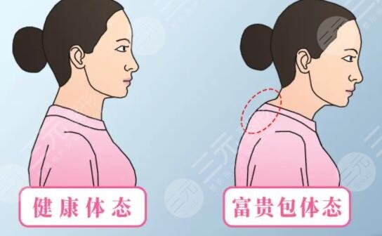 富貴包