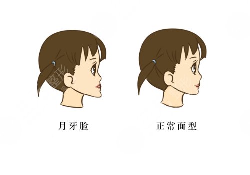 中山大學(xué)附屬口腔醫(yī)院做正頜手術(shù)怎么樣