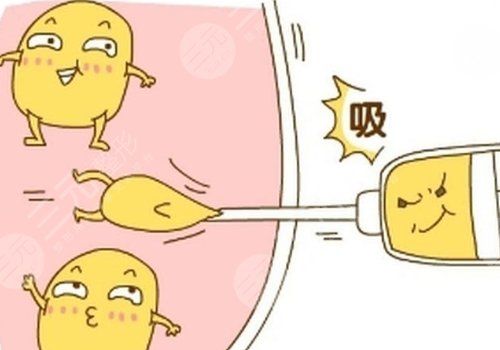 北京禾美嘉吸脂怎么樣
