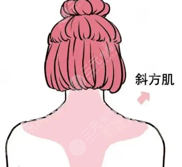 吸脂瘦后背