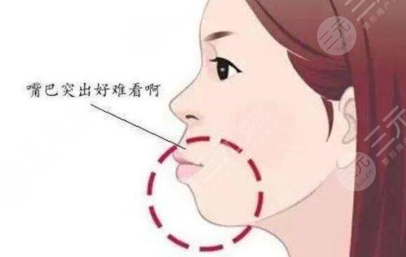 正頜