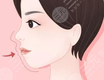 凸嘴矯正