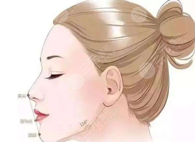 凸嘴矯正