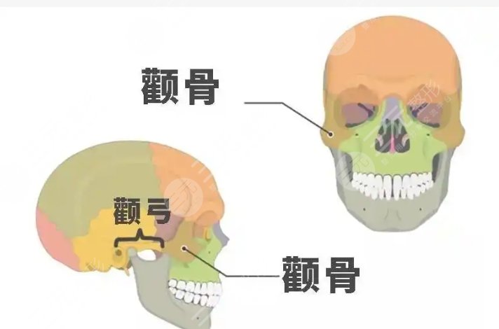 顴骨磨骨