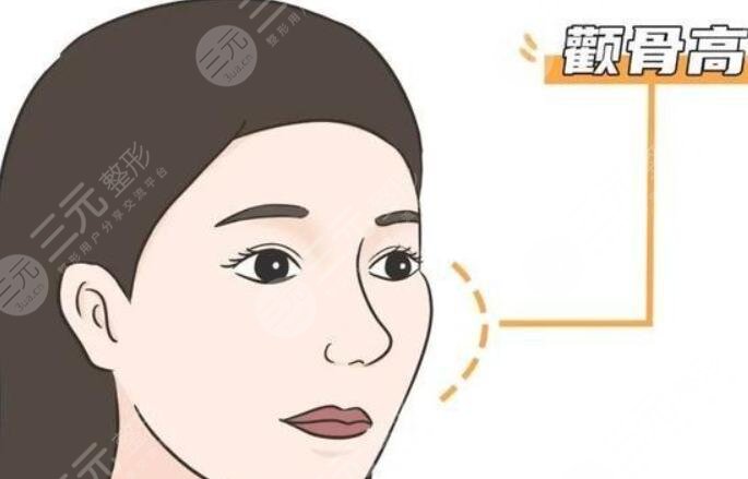 顴骨