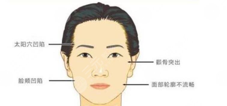 顴骨