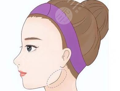 瘦臉