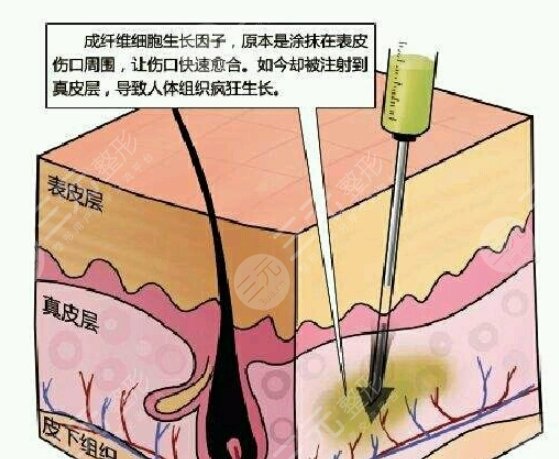生長因子