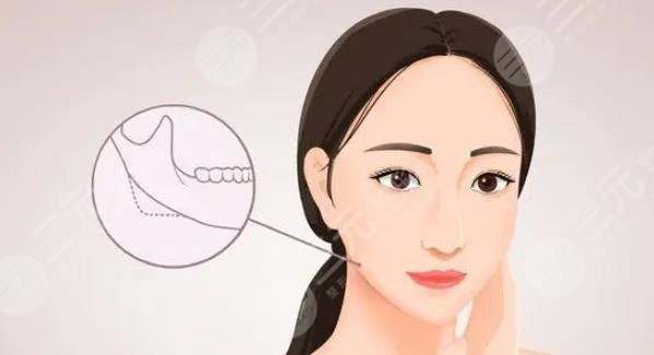 輪廓