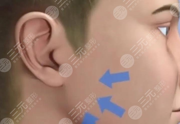 輪廓