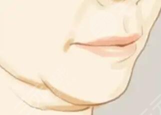 雙下巴