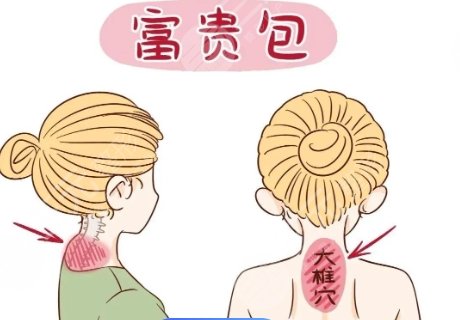 富貴包