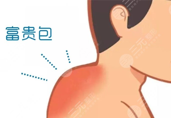 富貴包