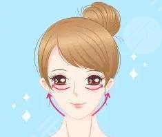 輪廓整形