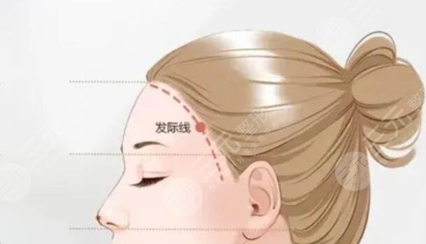 發(fā)際線
