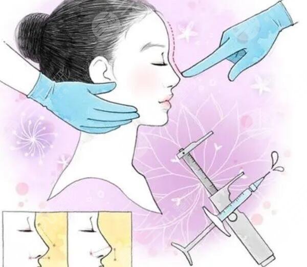 歪鼻矯正