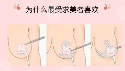 縮胸