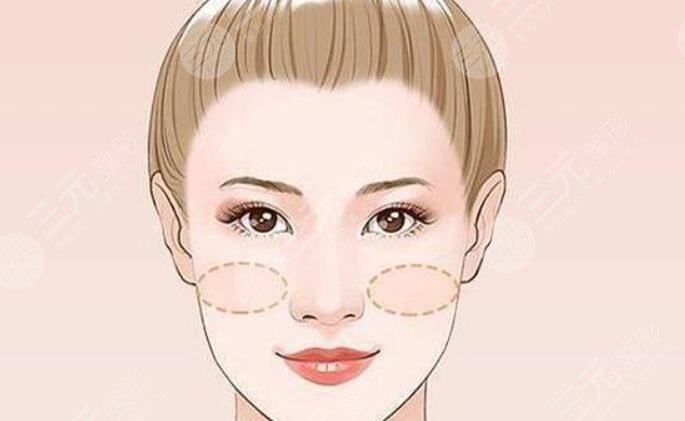蘋果肌
