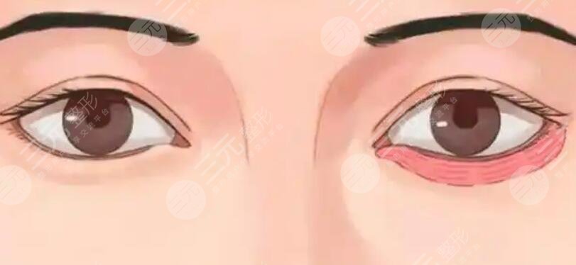 臥蠶