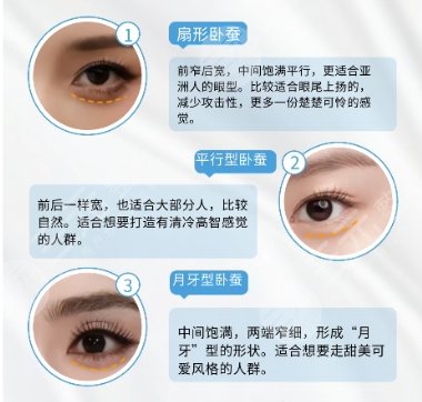 臥蠶再造