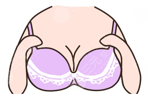南方醫(yī)院隆胸價(jià)格是多少