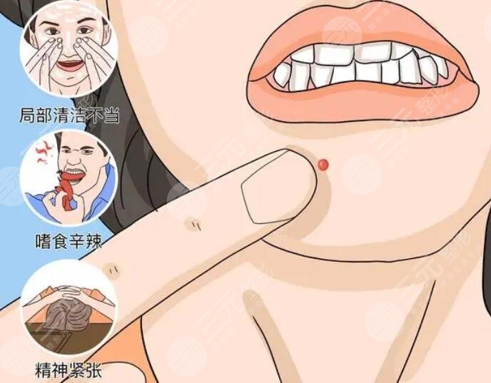 祛痘