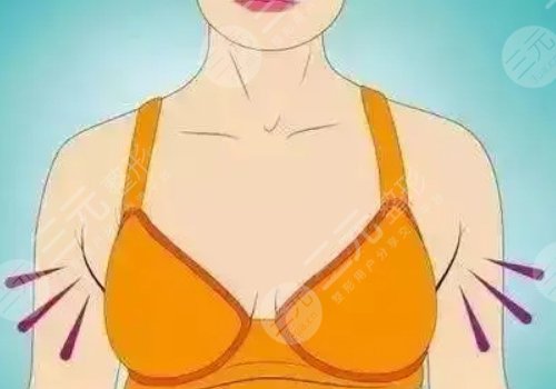 成都美萊隆胸好不好？技術穩(wěn)|審美佳|案例展示！