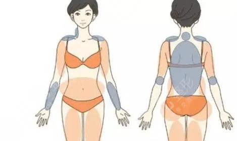 抽脂