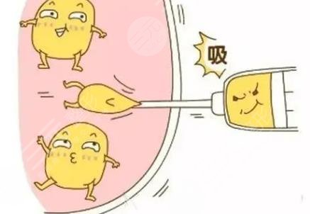 抽脂