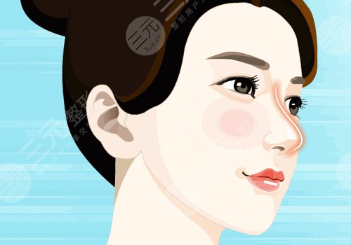 杭州藝星假體隆胸價格是多少？大概在2.3w起；性價比高