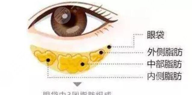 眼袋