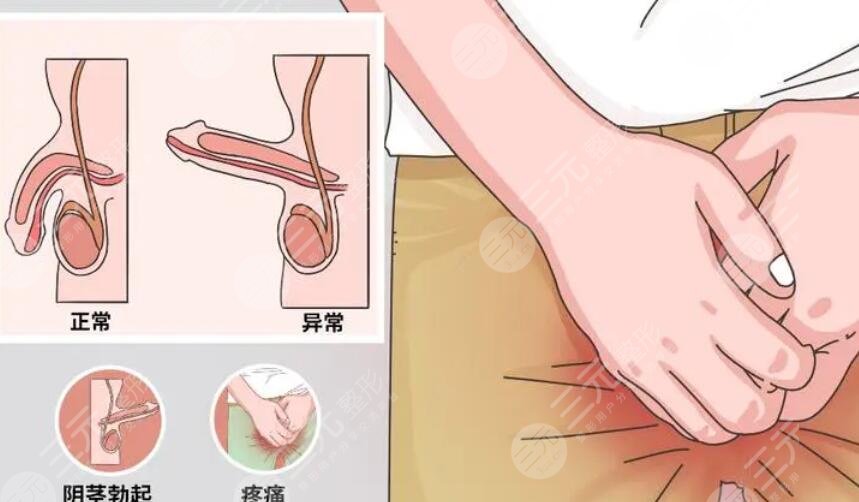 私密整形