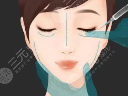 玻尿酸五官塑形